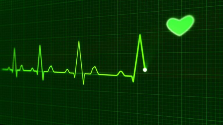 Arritmia Cardíaca – Causas, Diagnóstico, Prevenção e Tratamento