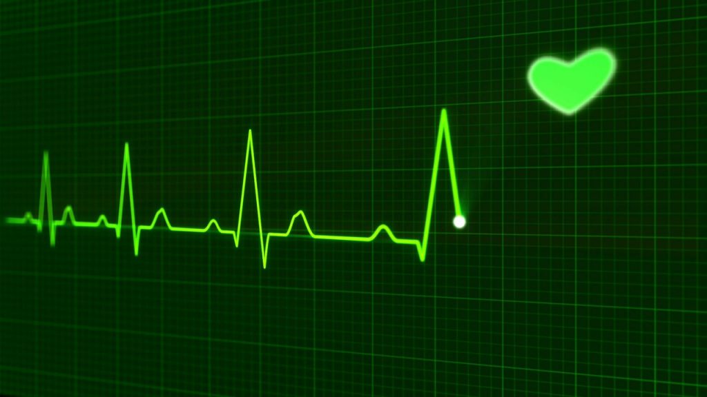 arritmia cardíaca, Arritmia Cardíaca &#8211; Causas, Diagnóstico, Prevenção e Tratamento, Abreu Cardiologia